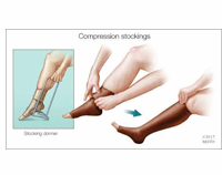 picture-of-people-wearing-compression-socks