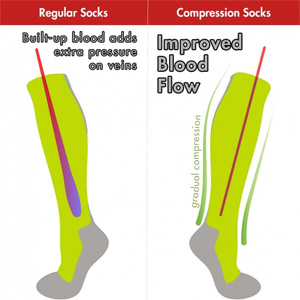 picture demonstrating difference between regular and compression socks showing improved blood flow