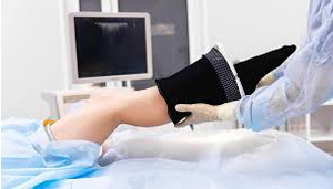 picture of a nurse putting on doctor recommended compression stockings to a patient after surgery