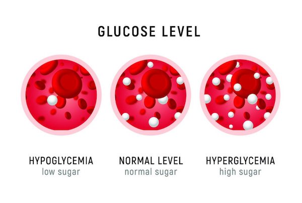 illustration of blood sugar levels from low sugar level to normal level to high sugar level