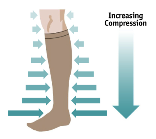 best compression socks for swelling in legs