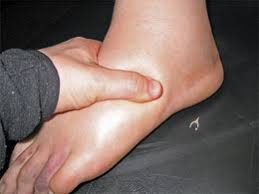 A person doing finger test on edema patient 