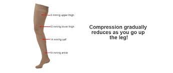 External graduated compression: Compression reduces as you go up the leg