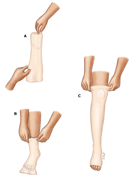 Heel pocket out method