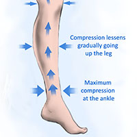 how compression socks work for athletes