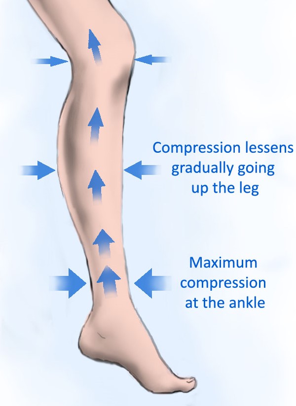 How compression socks work