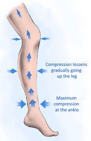 How Graduated compression stockings work