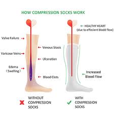 An illustration of how compression socks improve blood circulation