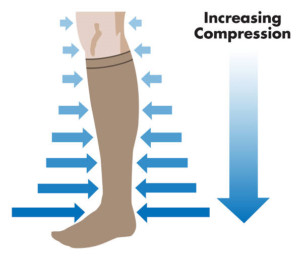 Illustration Showing Graduated Compression