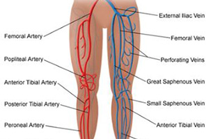 Improve Venous Competence 