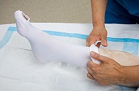  A nurse helping a patient put on anti-clot stockings