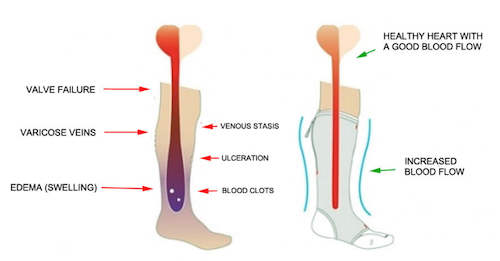 Graphic of feet explaining blood circulation