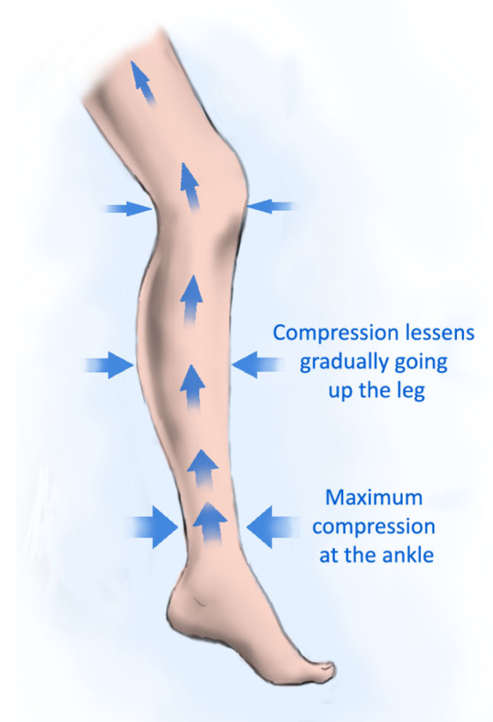 How compression socks work