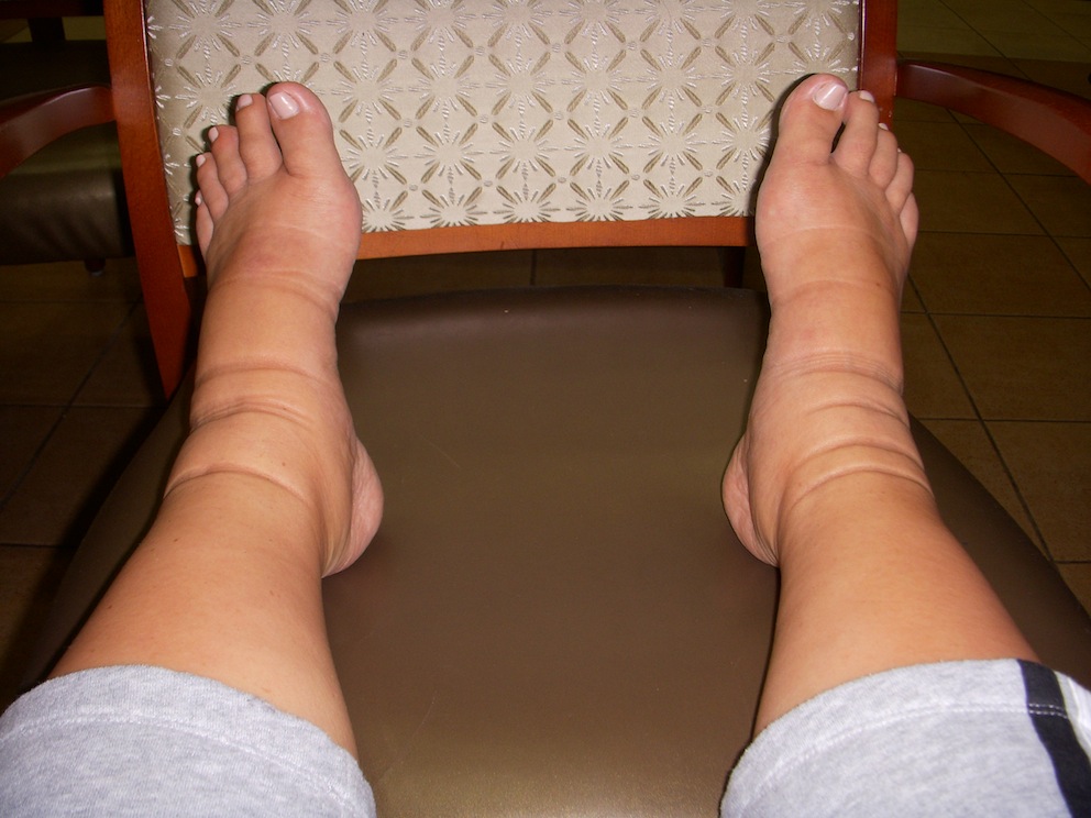 pregnant-socks-best-pregnancy-socks-to-stop-swelling