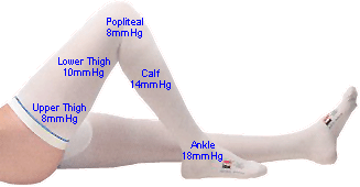 TED Compression Stockings Complete Guide with Pictures 