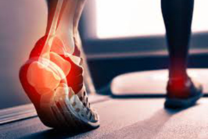 achilles tendinitis in sports