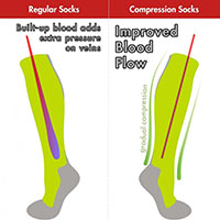 compression socks improve blood flow