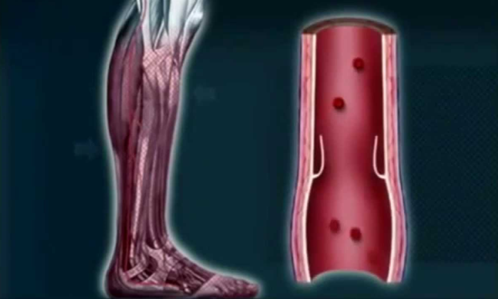 blood flow in legs