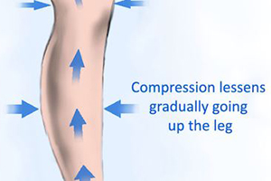 compression of compression socks decreases upwards