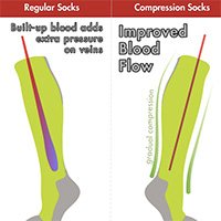 Compression Sock Benefits - Compression Socks improve blood flow by adding gradual compression from the ankle up the calf all the way knee high