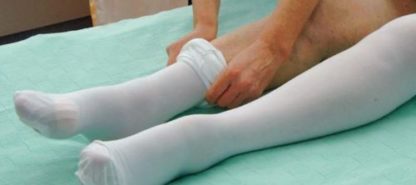 how long should compression stockings be worn after surgery