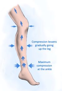 A demonstration of how graduated compression improves blood flow