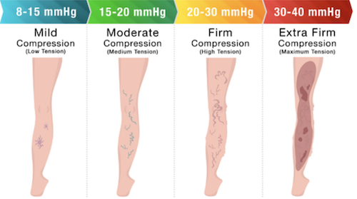 Compression Stockings Compression Levels