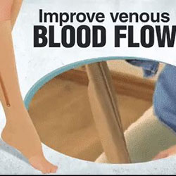 support hosiery improves venous flow