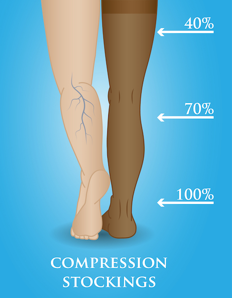 healthy stockings Pantyhose compression