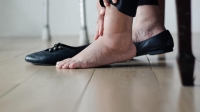 diabetic-patient's-swollen-feet