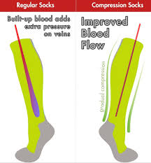 compression hosiery