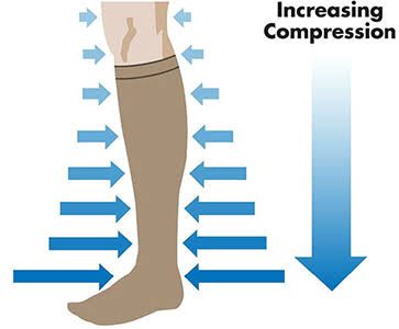 gradual pressure of compression socks reduces swelling