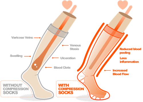graduated compression socks and their effect on blood flow in runners