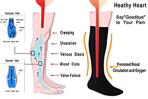 What Do Compression Socks Do - Read Complete Guide
