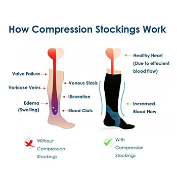 how compression socks work
