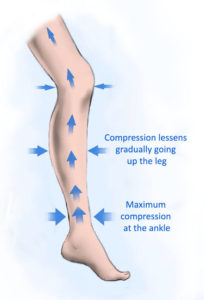 how compression socks for nurses exactly work.
