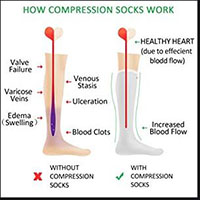 how compression support socks work