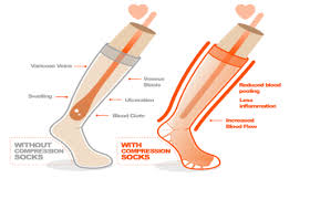 How Do Compression Socks Work On Our Legs? - (All You Need to Know!)