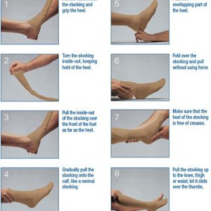 Varicose Veins Compression Stockings – Complete Guide (with Pictures)