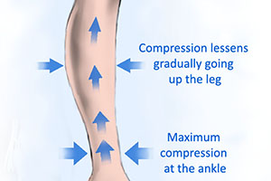 legs compression leg sleeves have high pressure at the ankle