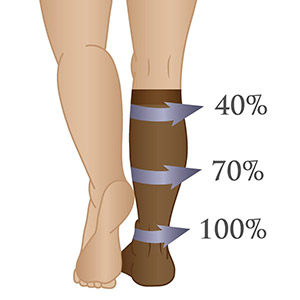 An image showing compression level distribution in pressure socks