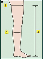 Open Toe Compression Socks - Compression Guide (for Open Toe Stockings!)