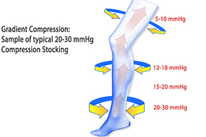 mechanical action of compression socks