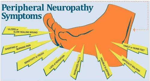 People with peripheral neuropathy should consult their doctor before using compression socks.