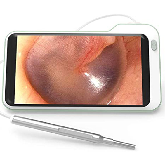 Video otoscopes