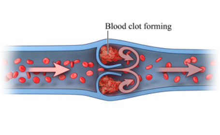 formation of blood clots