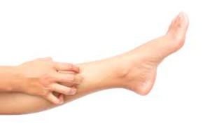 prevent itchy legs