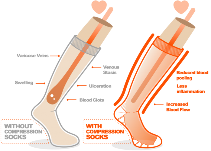 compression socks and how it helps in blood circulation