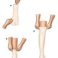 steps for wearing support hoses