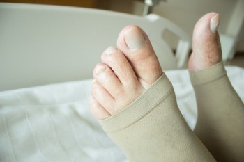 Ted Hose vs Compression Stockings: What's the Difference?